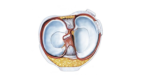 Dolor dvt rodilla la síntomas en
